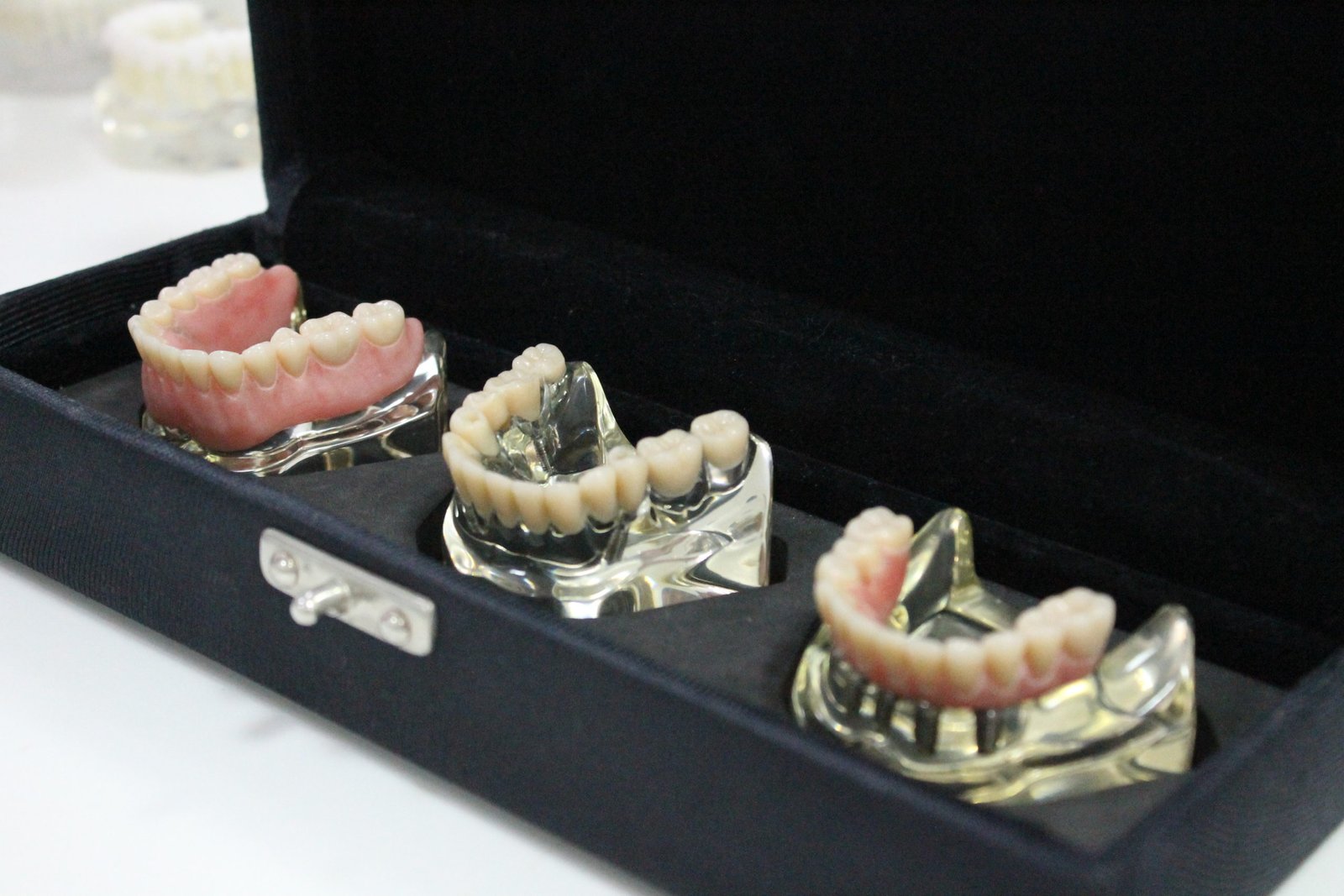 Implante dentário: Conheça todo o processo até o seu sorriso perfeito!